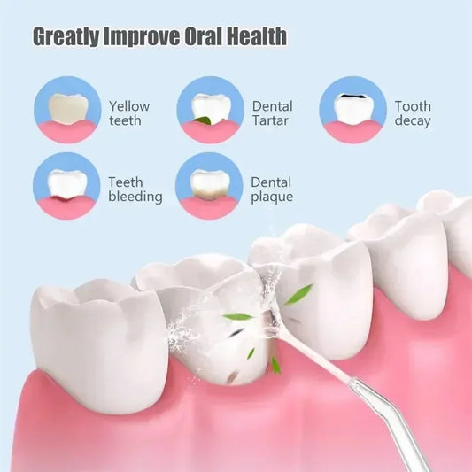  Dental Floss Portable Cordless Oral Irrigator Cleaning 3 Modes Waterproof Rechargeable Dental Cleaner With 4 Nozzles Clean Gum